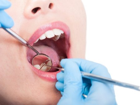 With proper treatment, one can completely eliminate oral galvanism. Oral galvanism, burning mouth syndrome