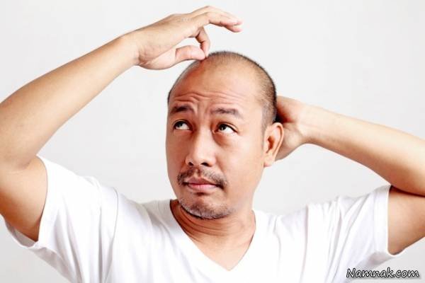 Best Hair Transplant Method