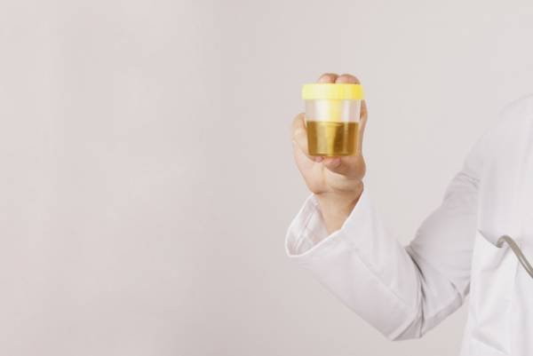 Urine and blood pH