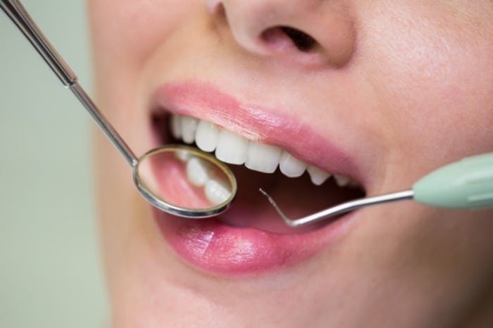 Causes of Tooth Discoloration.