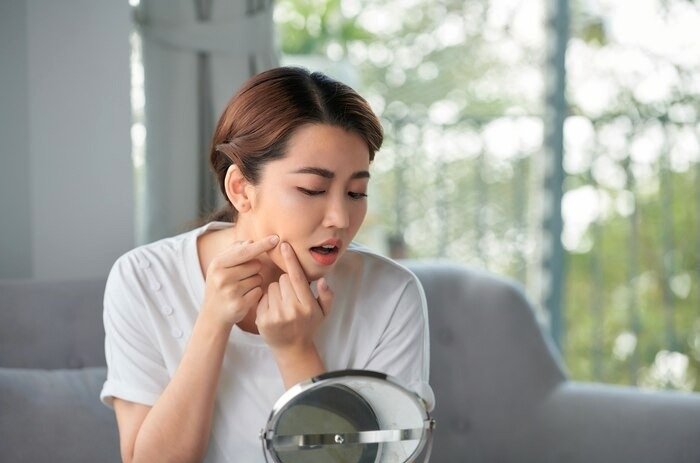 Facial pimples