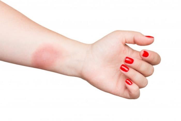 Benefits of Aloe Vera for the Body