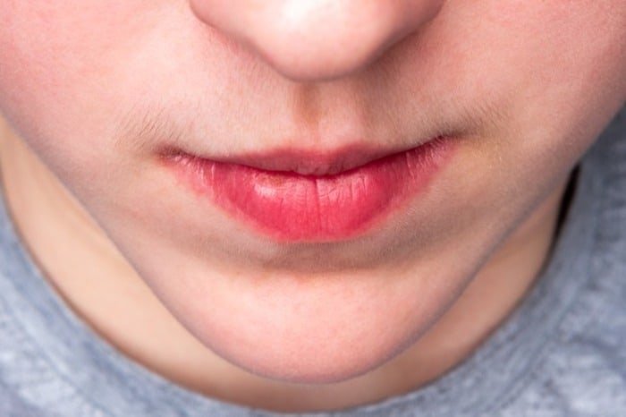 Methods to Eliminate Hair Above the Lip