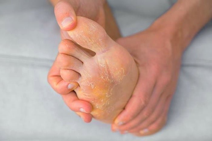 Foot itching at night