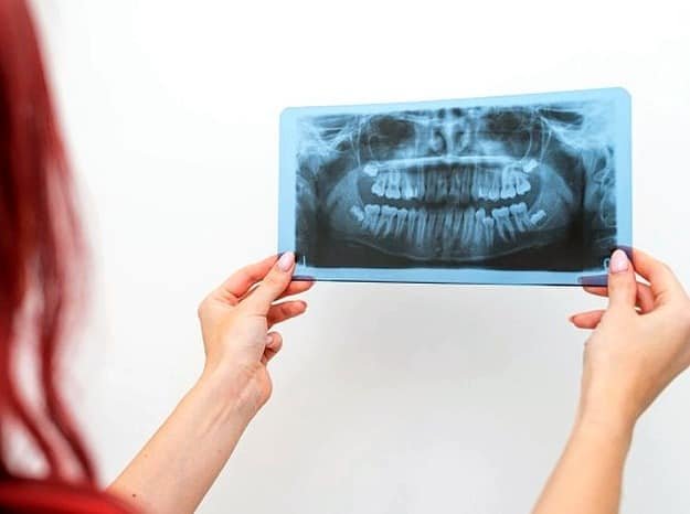 Dental diagnostic test