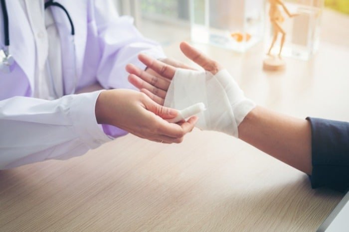 First Aid for Burns