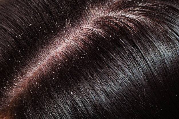 Argan Oil for Skin and Acne Treatment