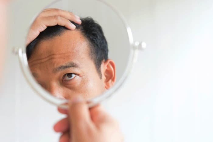 Hair loss