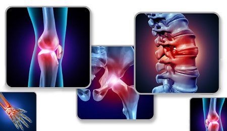 Correct posture is key to preventing many musculoskeletal disorders. Preventing musculoskeletal disorders, joint pain prevention.