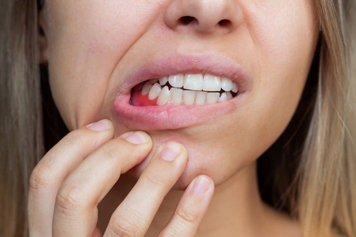 Gum issues are signs of bone problems