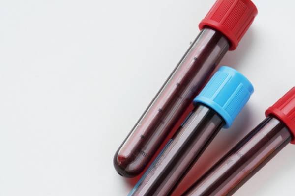 /Genetic Tests