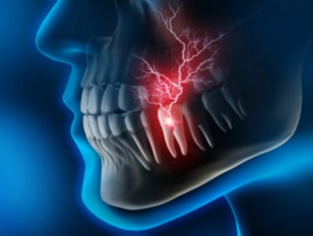 The main cause of galvanism is the presence of different metals in the mouth. Oral galvanism, burning mouth syndrome