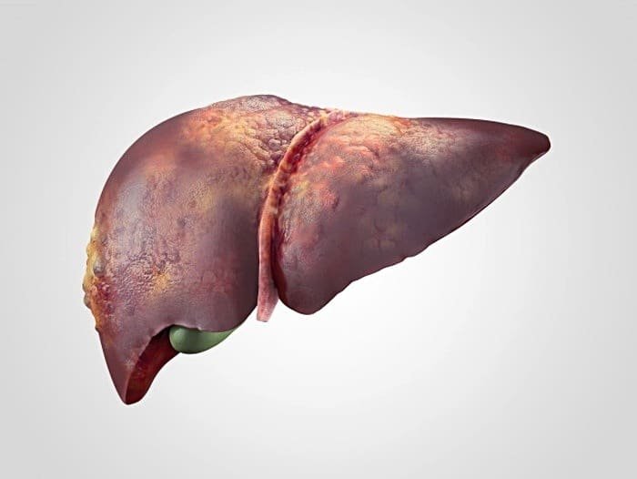 The cause of fatty liver