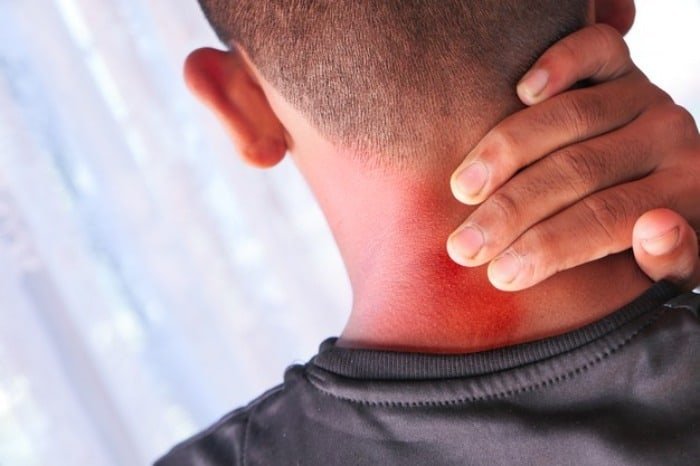 Factors that transfer pain from the neck to the head