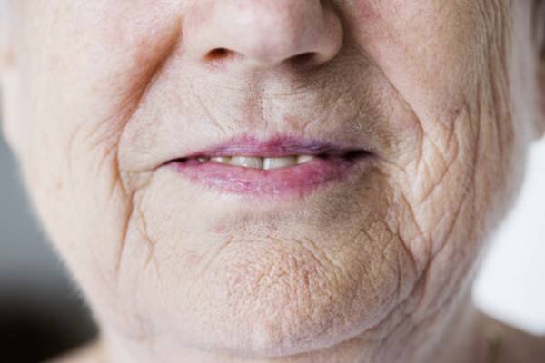 Humidifier for treating dry skin on the nose