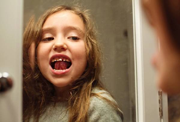Permanent Teeth