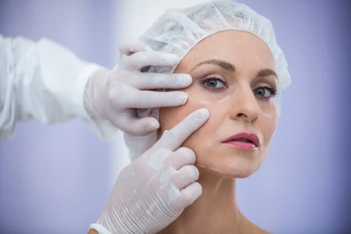 How blepharoplasty is performed