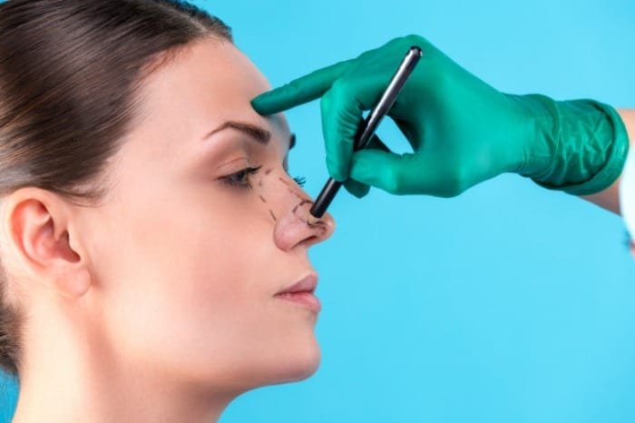 Complications of Nose Surgery After Several Years