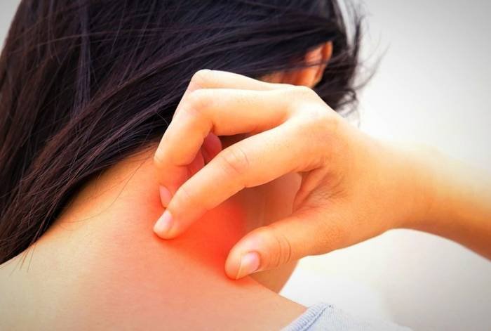 The connection between liver disease and skin itching