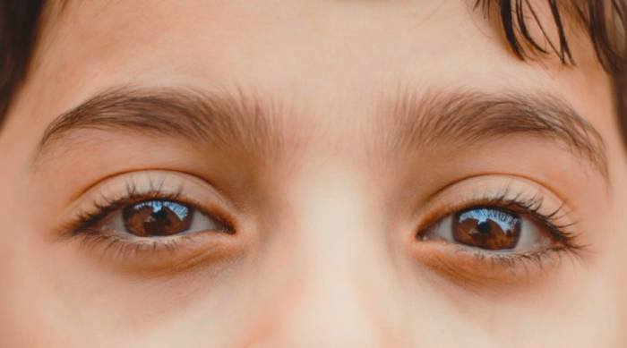 Eye check