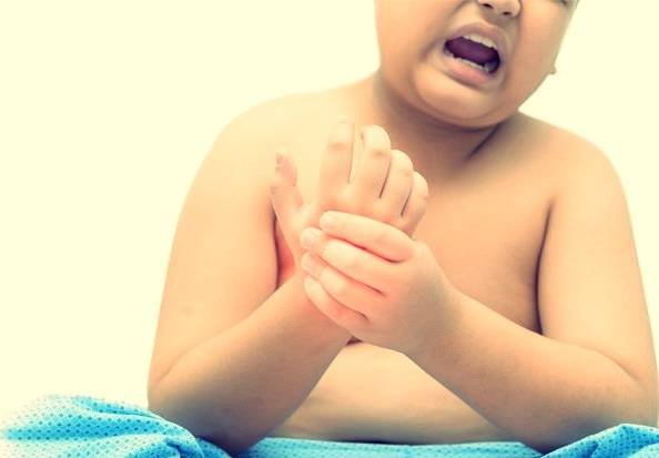 Treatment of Arthritis in Children and Teens