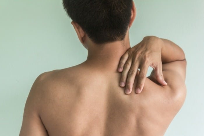 Bursitis