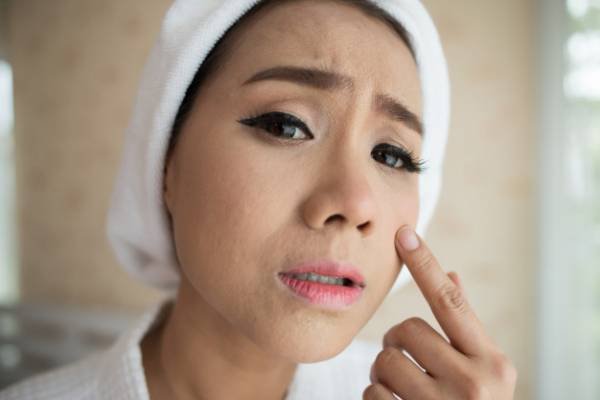 Removing Pimples and Spots