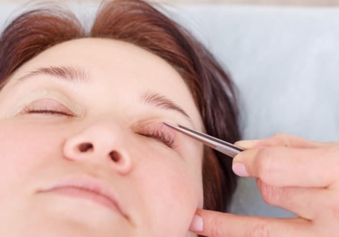 Complications of blepharoplasty