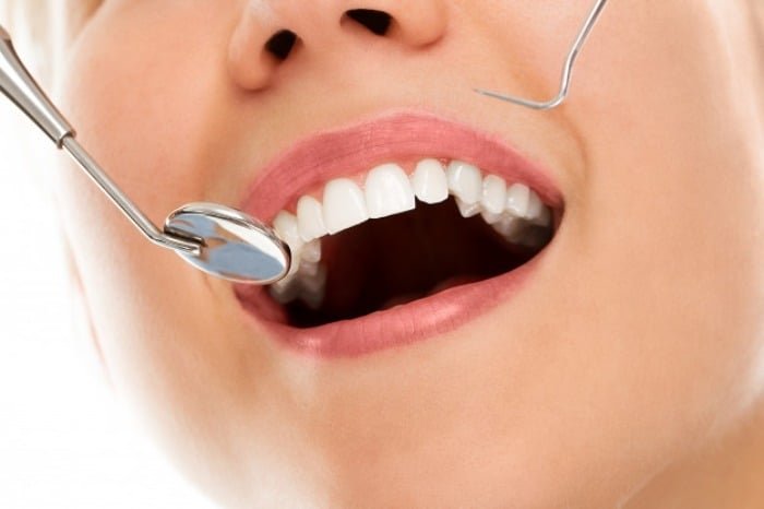 Dental laminate