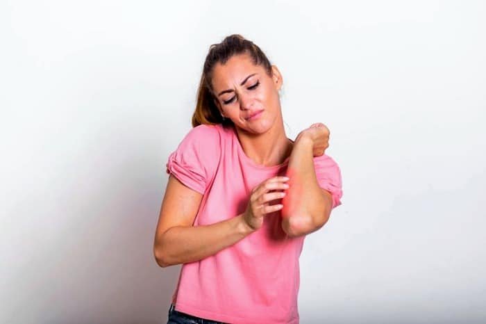 Doxycycline Side Effects
