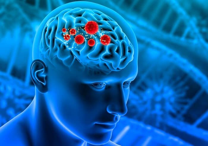 Brain Infection