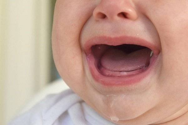 Hereditary Nature of Natal Teeth