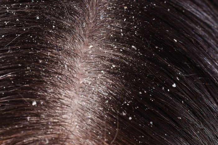 hair loss problems in women