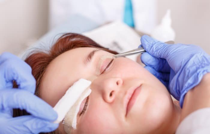 Care after blepharoplasty