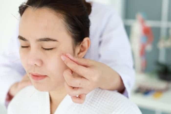 Acupuncture for Reducing Excess Hair