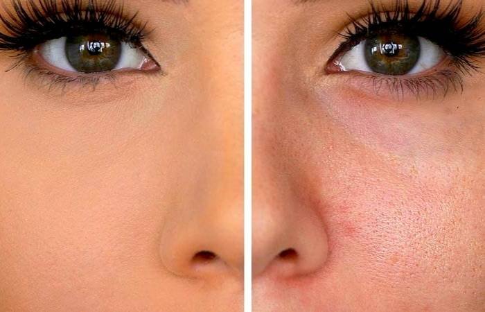 Reducing Skin Aging