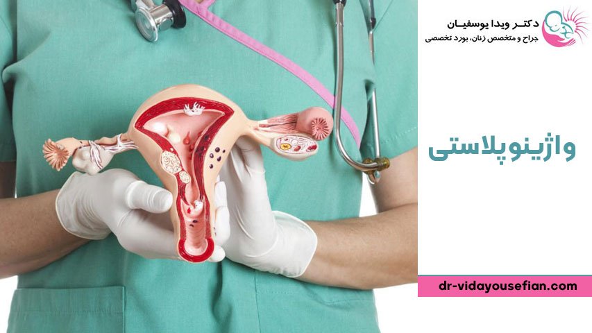 Vaginoplasty