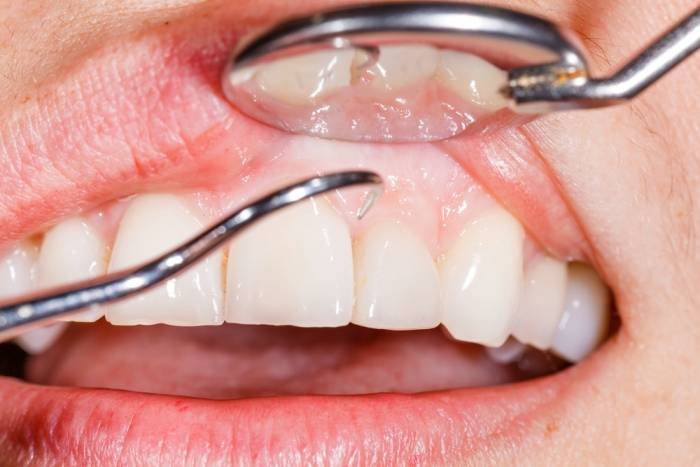 Periodontist
