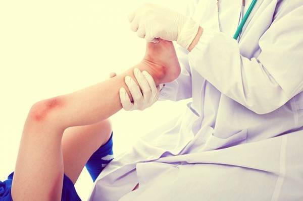 Treatment of Joint Pain in Children