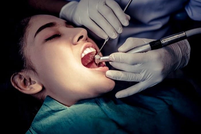 Dental Fillers