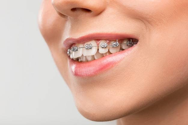 Orthodontist introduction