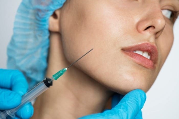 Subcision for treating acne scars on the face