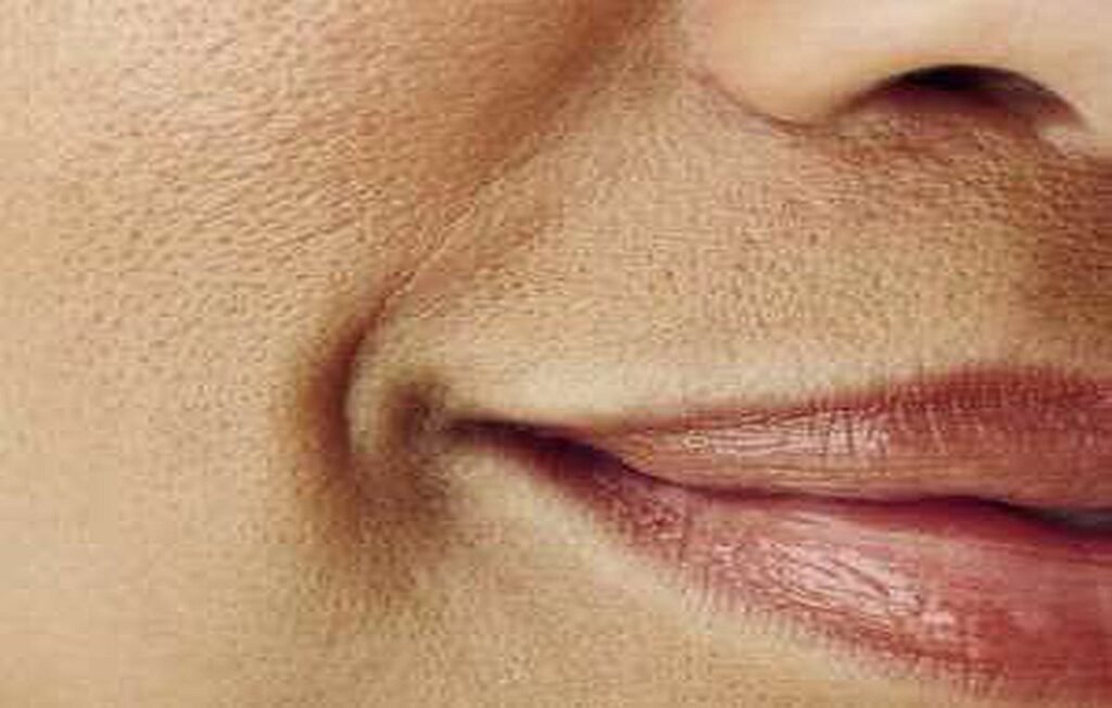 25 Herbal Masks for Treating Orange Peel Skin and Closing “Open Pores”