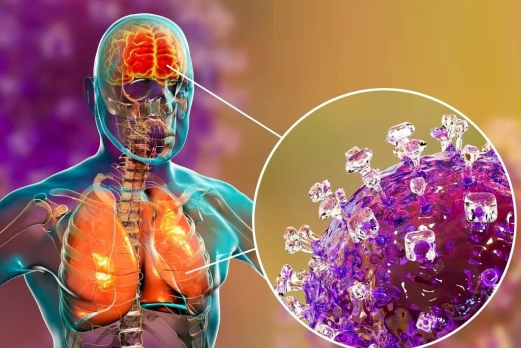 Nipah Virus: What It Is, Its Symptoms, and How It Spreads